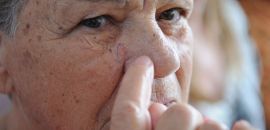 Pesquisadores desenvolvem software para diagnosticar melanoma