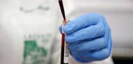 Paraná tem quatro laboratórios habilitados para ajudar nos testes