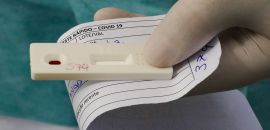 Saiba como fazer o teste diagnóstico de covid-19 pelo plano de saúde