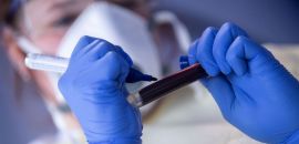 ANS retira teste para covid-19 de lista obrigatória de cobertura